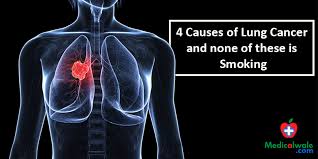 Exposure to radon (an odorless gas found in homes) is often to blame, explains robert mckenna, jr oftentimes, people aren't on the lookout for them because they're not a smoker—and by the time the telltale signs of lung cancer appear, like chest. 4 Causes Of Lung Cancer And None Of These Is Smoking Non Smokers Lung Cancer Medicalwale Com