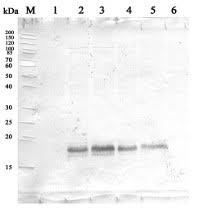 The results showed that the igg ascs were scattered in the lamina propria (lp). Goat Anti Rabbit Igg H L Ap Conjugated Secondary Antibody