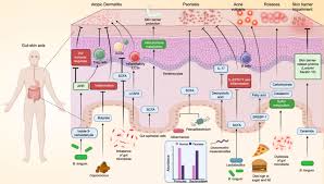 Gut–X axis - Lin - 2025 - iMeta - Wiley Online Library