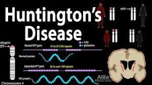 Huntington's disease is caused by an inherited defect in a single gene. Huntington S Disease Genetics Pathology And Symptoms Animation Youtube