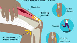 What functions does the four ligaments have in the knee? Thigh Pain Causes Treatment And When To See A Doctor