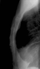 Sternum — stèrnum m definicija anat. The Sternum Body Manubrium Xiphoid Teachmeanatomy