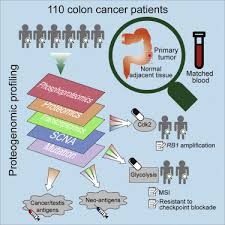 Colorectal cancer (colon cancer) is the cause of many cancer deaths. Proteogenomic Analysis Of Human Colon Cancer Reveals New Therapeutic Opportunities Sciencedirect