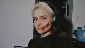 small face laceration 🔪