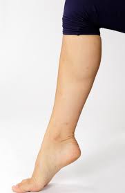 Sprunggelenksarthrose Gelenkerhaltend Therapieren Gelenk Klinik De