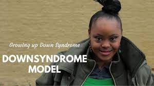Welcome to the down syndrome health channel by emedtv. Down Syndrome Model Gigi Cunningham Youtube