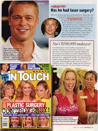 Did you know result of brad pitt acne scars? In Touch 2004 Brad Pitt Has He Had Laser Surgery Dr Haworth