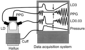 A classification of hypertension and prehypertension from the joint national committee on prevention, detection, evaluation, and treatment of high blood pressure is given in. The Usefulness Of A Laser Doppler In The Measurement Of Toe Blood Pressures Sciencedirect