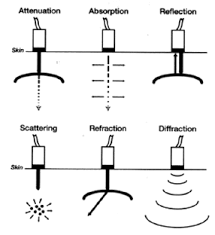 Pin By Susan Barr On Vascular Sonography Ultrasound Sonography Ultrasound Diagnostic Medical Sonography