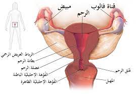 مرض التهاب الحوض ويكيبيديا