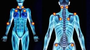 22 видео 56 просмотров обновлен 22 февр. Fibromialgia O Artitris Diferencias Sintomas Y Tratamiento
