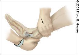 It might prevent you from putting your full weight on the ankle. Management Of Ankle Sprains American Family Physician