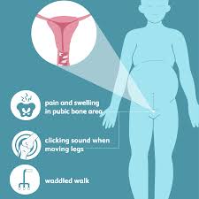 Pubic Bone Pain In Pregnancy