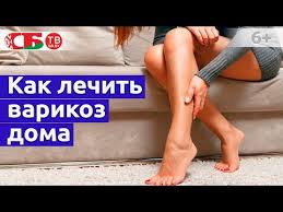 как лечить варикоз на ногах у женщин в домашних условиях Kak Lechit Varikoz V Domashnih Usloviyah Youtube