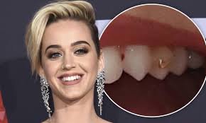 Katy Perry shows off her gold Nike TOOTH JEWELRY