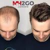 Alibaba.com offers 1,757 fake hair men products. 1