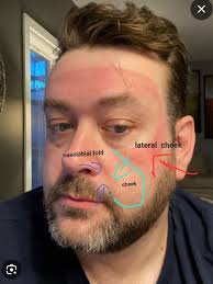 What motivated you to get back in the headset?