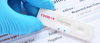 Antigen Test Peer