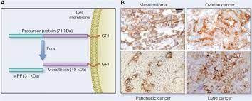 There are a lot of them! Adc Development For Mesothelin Expressing Tumours Creative Biolabs