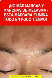 Pin En Cara