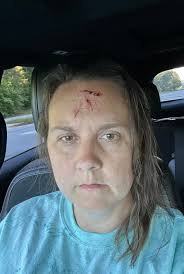 Blood pressure was 225/90 after dizzy spell