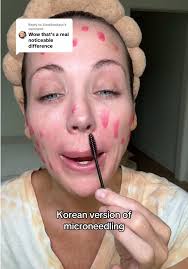 Korean Skincare Innovations: Spicule Serum Benefits