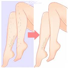 My health clinic kuantan (24jam), kuantan, pahang, malaysia. Best Hair Removal In Kuantan Price Guide Reviews