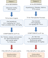 Systemic Retinoids And Thyrotoxicosis In Multi Nodular