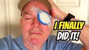 Joe Arndt's Cataract Surgery Experience