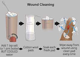 First Aid For Cuts And Grazes Pdsa