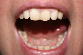 images?q=tbn:ANd9GcQrn9yd8u-TgZgP54nRt0F