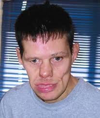 Stephen Welke Obituary