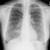 肺 レントゲン 健康