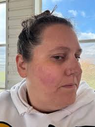 I just feel tired all the time. And I get winded as im walking down the  hallway at work as cna. I was in hospital for fluid