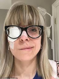 The dictionary definition of twitch is a sudden involuntary or spasmodic muscular movement. Teacher S Eye Twitch Turned Out To Be Shingles Which Left Her With An Paralysed Face Daily Mail Online