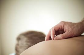 Order must contain at least $75 of acupuncture needles at checkout before shipping or taxes. Do Silver Needles Make Acupuncture More Effective Acupuncture Rumson