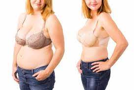 Many breast reductions are medically necessary. Will Medicare Cover Breast Reduction Surgery Coco Ruby Plastic Surgery