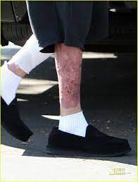 Dj am couldn't handle it and died. Full Sized Photo Of Travis Barker Post Crash Pictures 07 Photo 1503421 Just Jared