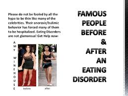 Check spelling or type a new query. Eating Disorders Before And After By Lucia Raposo