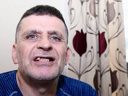 Man had to wear dead man's dentures because he couldn't find NHS dentist