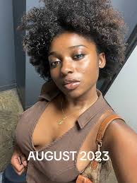 Tretinoin Before and After African Girl