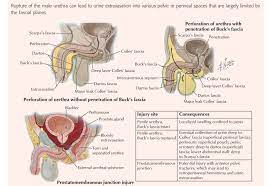 Urethral Injury 02 Urethra Medical Anatomy Fascia Anatomy