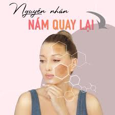 Damian Việt Nam