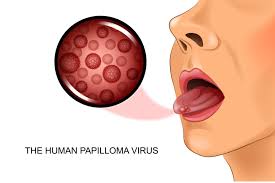Image result for papillomavirus tongue)