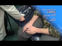 Pin On Crps Rsd