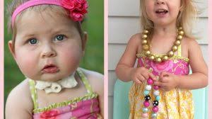 Pierre Robin Sequence Awareness Day 2016