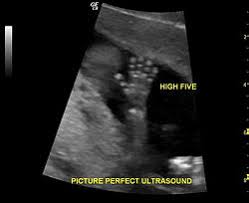 Image result for Biophysical Profile