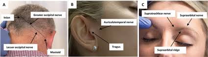 Image result for Ear Nerve Block