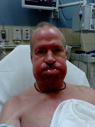 Beard Coloring For Sensitive Skin