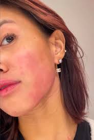 alpyn beauty Super Peptide & Ghostberry Moisturizer VS Tatcha The Dewy